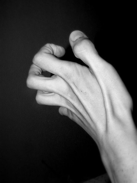 RA in Hands: What Hand Joints are Affected by Rheumatoid Arthritis