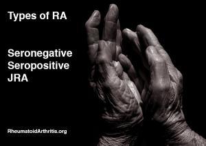 RA Types: What Distinguishes Types of Rheumatoid Arthritis ...